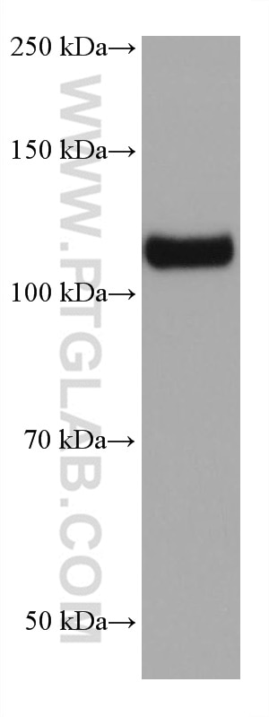 Western Blot (WB) analysis of 4T1 cells using USP15 Monoclonal antibody (67557-1-Ig)