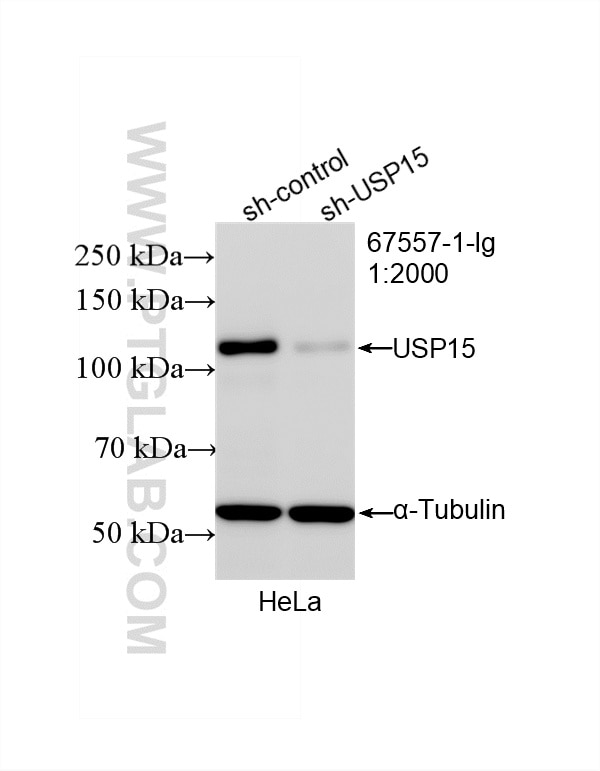 Western Blot (WB) analysis of HeLa cells using USP15 Monoclonal antibody (67557-1-Ig)