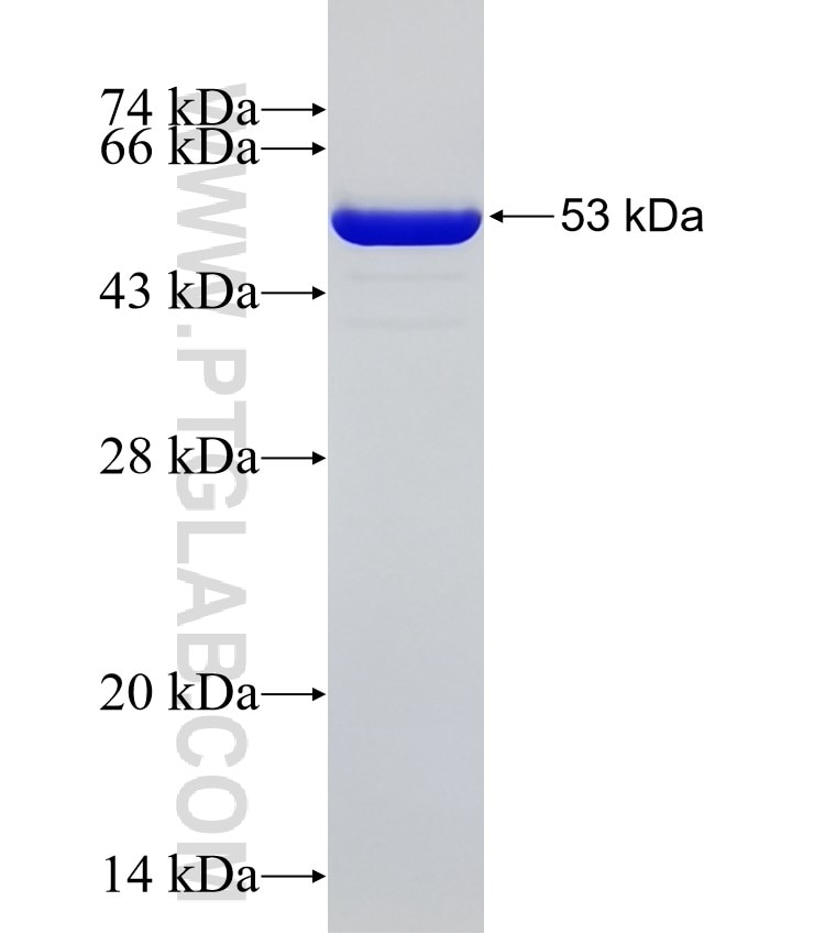 USP15 fusion protein Ag5703 SDS-PAGE