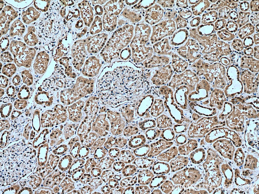 IHC staining of human kidney using 14055-1-AP