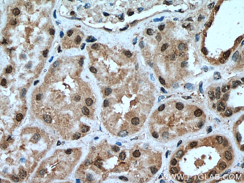 Immunohistochemistry (IHC) staining of human kidney tissue using USP16 Polyclonal antibody (14055-1-AP)