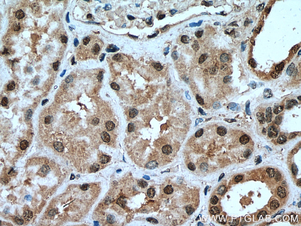 IHC staining of human kidney using 14055-1-AP