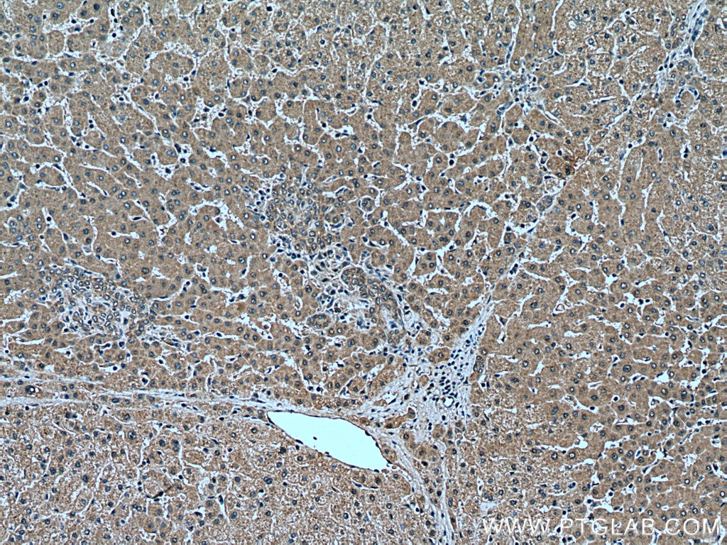 IHC staining of human liver using 14055-1-AP