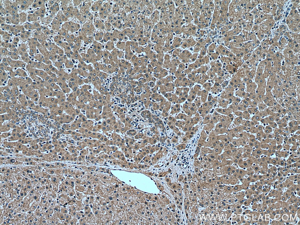 Immunohistochemistry (IHC) staining of human liver tissue using USP16 Polyclonal antibody (14055-1-AP)