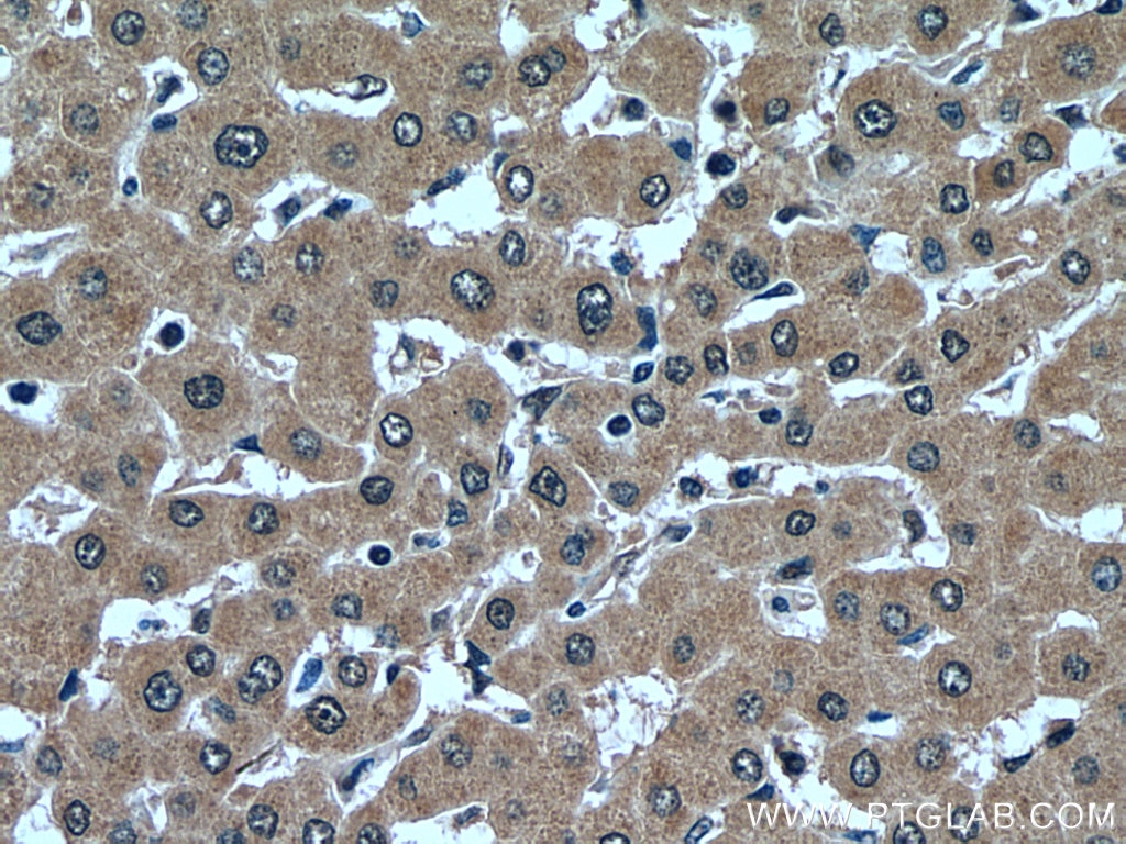 Immunohistochemistry (IHC) staining of human liver tissue using USP16 Polyclonal antibody (14055-1-AP)