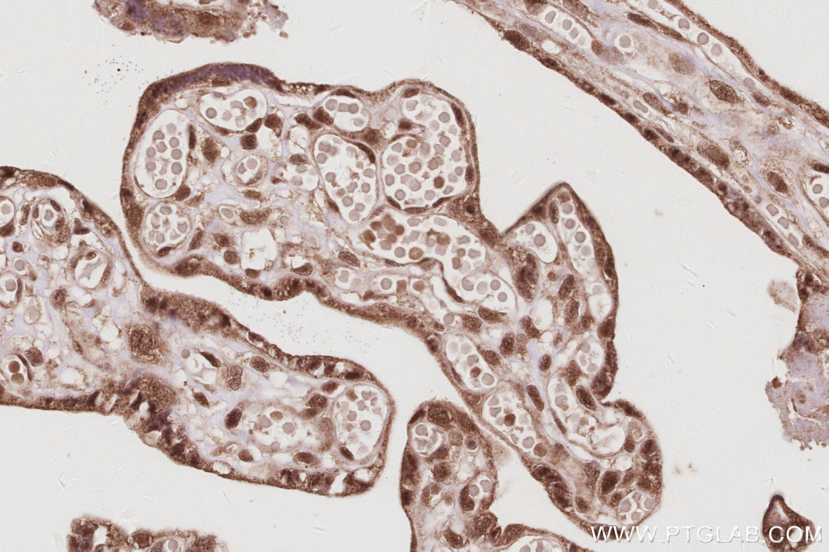 IHC staining of human placenta using 14055-1-AP Immunohistochemistry (IHC) staining of human placenta tissue using USP16 Polyclonal antibody (14055-1-AP)
