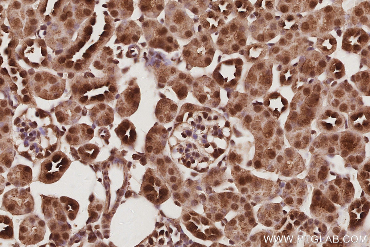 IHC staining of mouse kidney using 14055-1-AP Immunohistochemistry (IHC) staining of mouse kidney tissue using USP16 Polyclonal antibody (14055-1-AP)