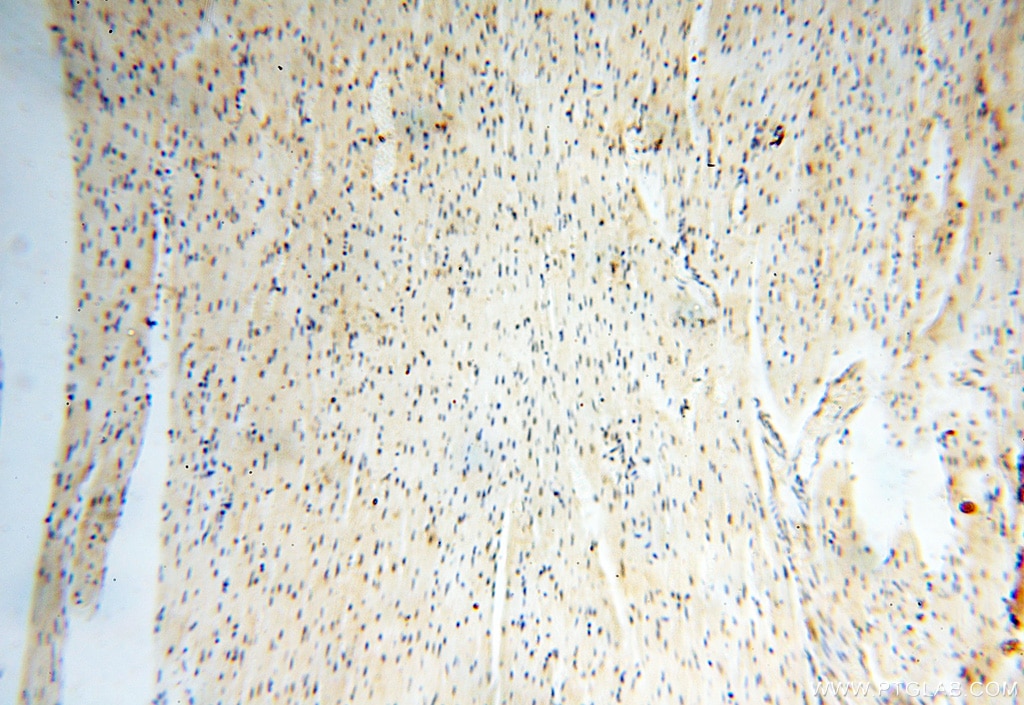 Immunohistochemistry (IHC) staining of human heart tissue using USP16 Polyclonal antibody (14055-1-AP)