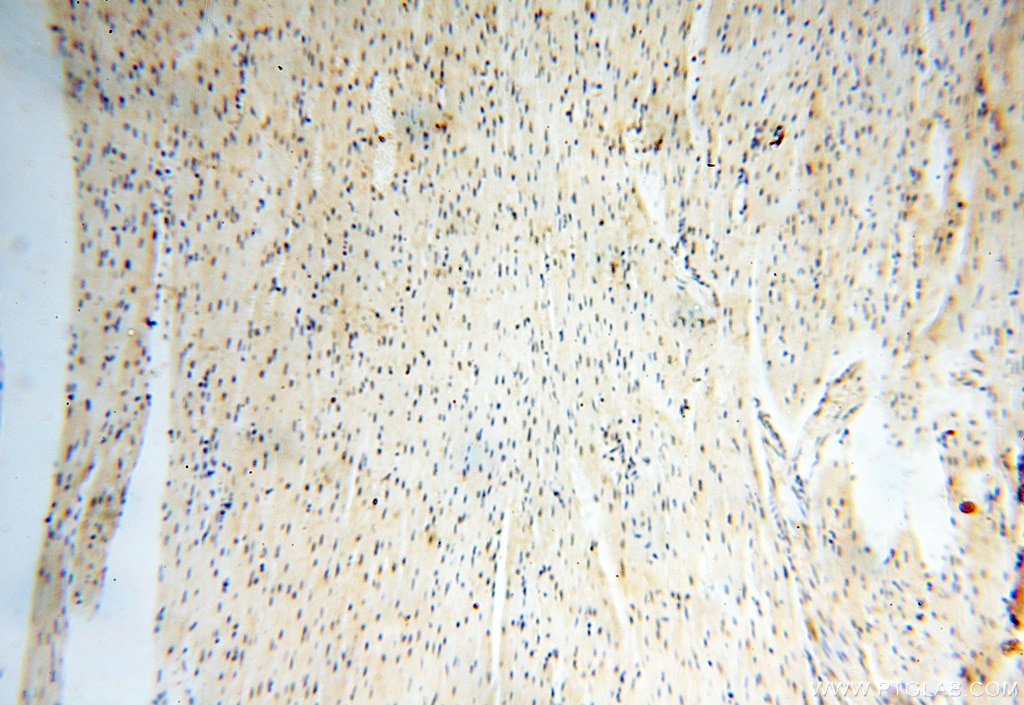 Immunohistochemistry (IHC) staining of human heart tissue using USP16 Polyclonal antibody (14055-1-AP)