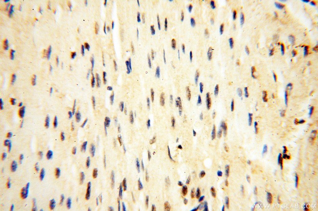 Immunohistochemistry (IHC) staining of human heart tissue using USP16 Polyclonal antibody (14055-1-AP)