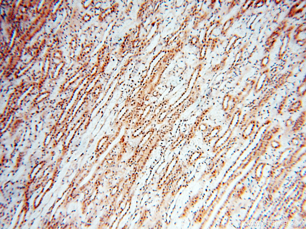 Immunohistochemistry (IHC) staining of human kidney tissue using USP16 Polyclonal antibody (14055-1-AP)