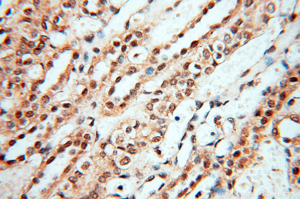 Immunohistochemistry (IHC) staining of human kidney tissue using USP16 Polyclonal antibody (14055-1-AP)