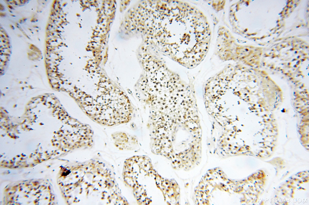 IHC staining of human testis using 14055-1-AP