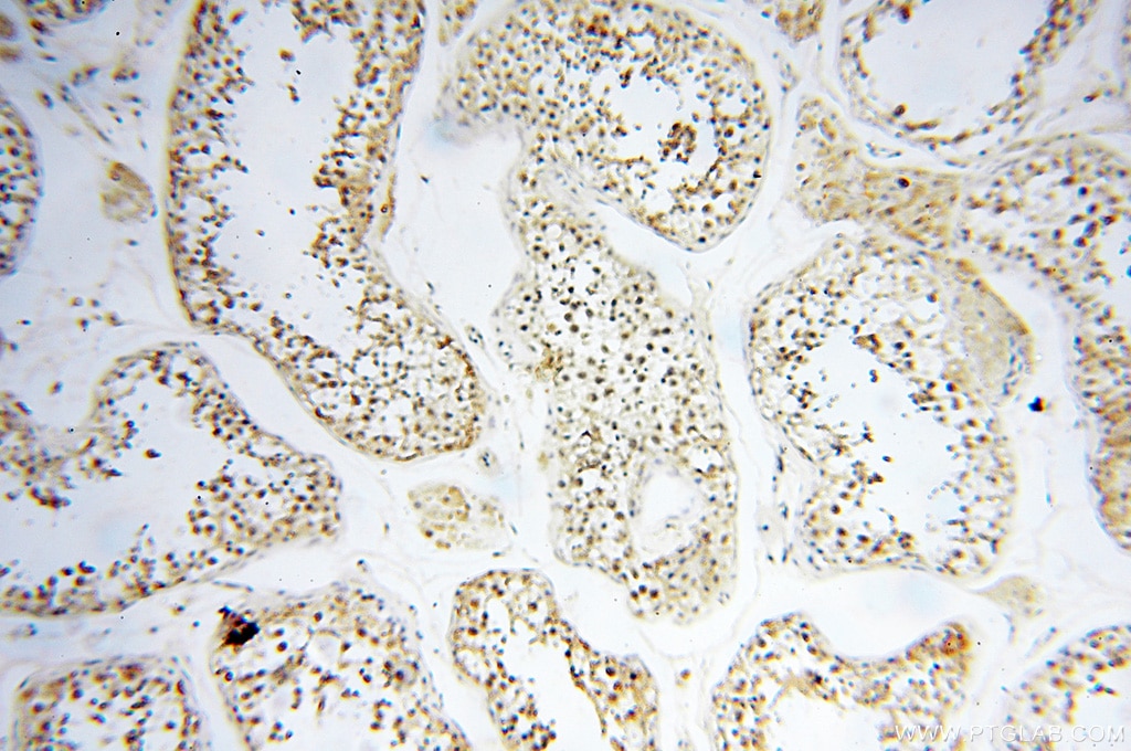 Immunohistochemistry (IHC) staining of human testis tissue using USP16 Polyclonal antibody (14055-1-AP)