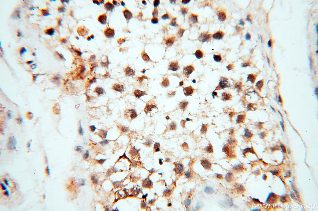 Immunohistochemistry (IHC) staining of human testis tissue using USP16 Polyclonal antibody (14055-1-AP)