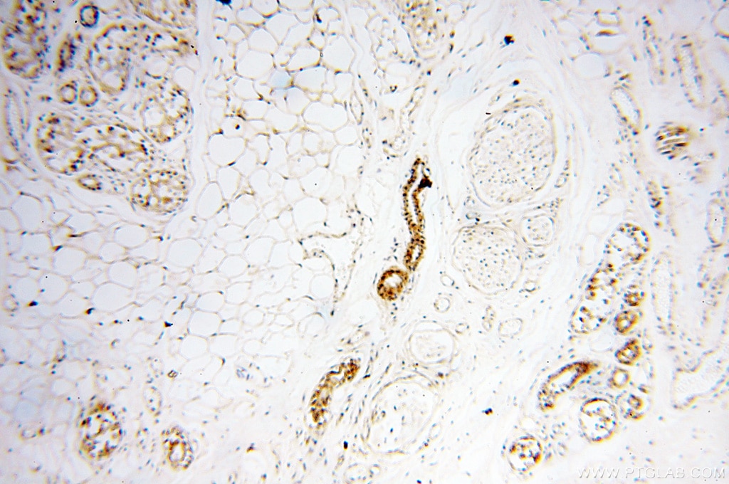 Immunohistochemistry (IHC) staining of human skin tissue using USP16 Polyclonal antibody (14055-1-AP)