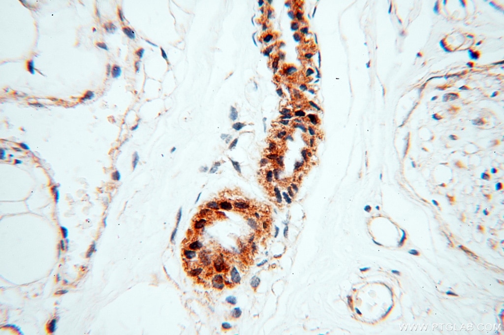 Immunohistochemistry (IHC) staining of human skin tissue using USP16 Polyclonal antibody (14055-1-AP)