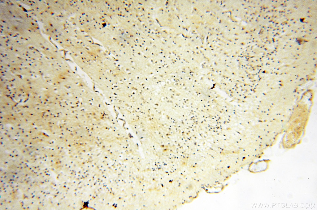 Immunohistochemistry (IHC) staining of human brain tissue using USP16 Polyclonal antibody (14055-1-AP)