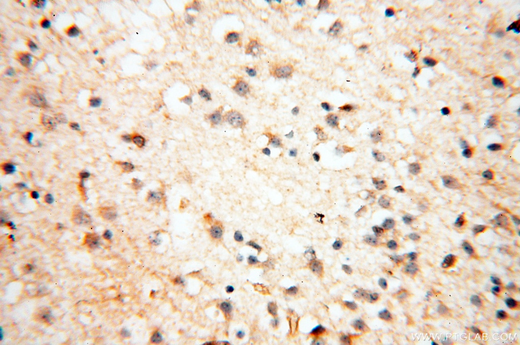 Immunohistochemistry (IHC) staining of human brain tissue using USP16 Polyclonal antibody (14055-1-AP)