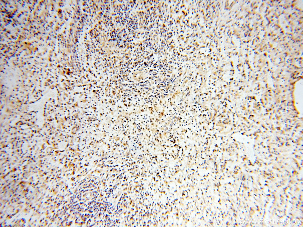IHC staining of human spleen using 14055-1-AP