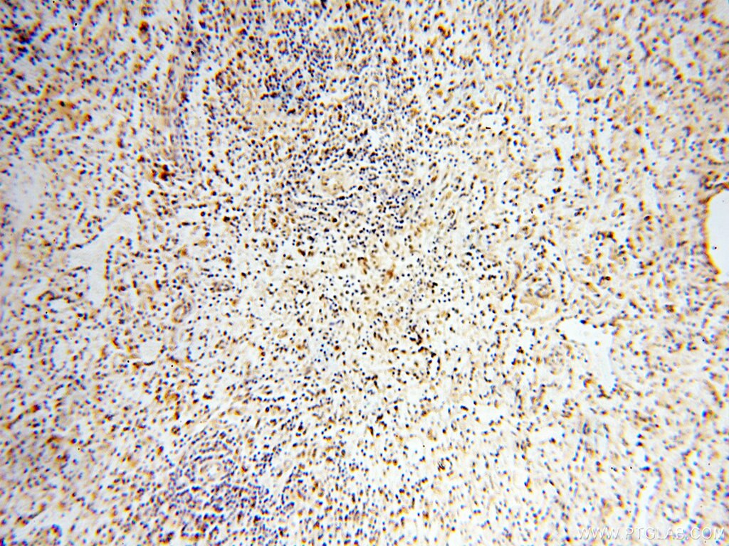 Immunohistochemistry (IHC) staining of human spleen tissue using USP16 Polyclonal antibody (14055-1-AP)