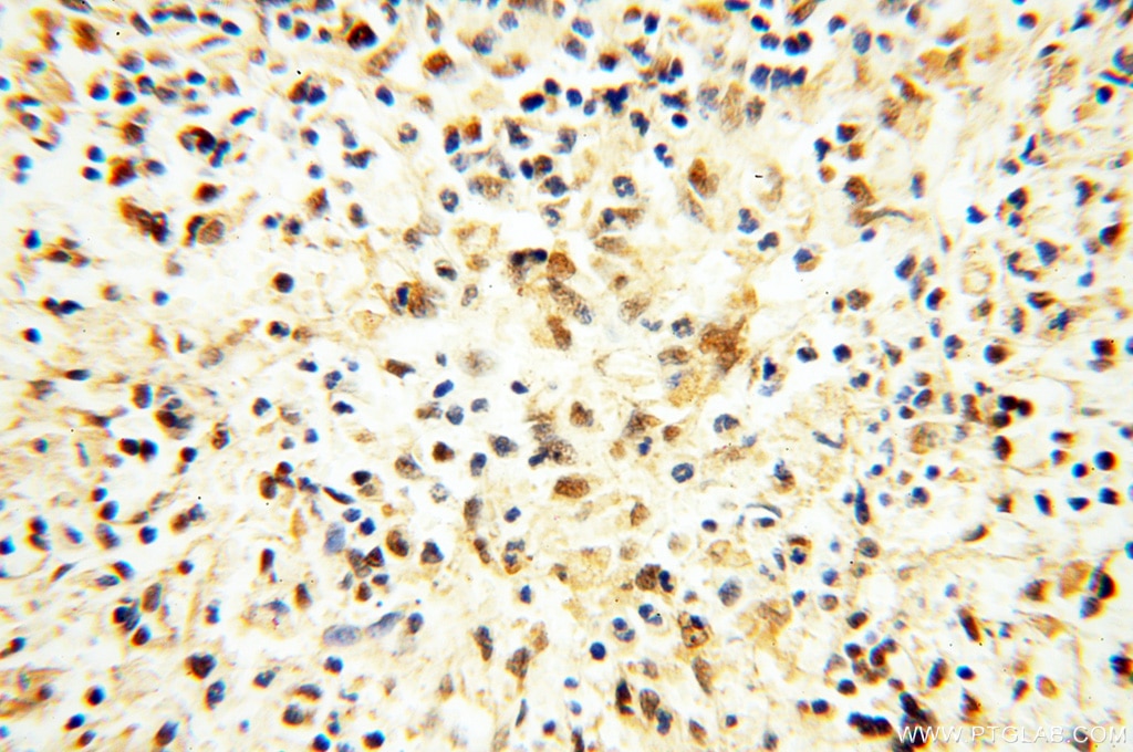 Immunohistochemistry (IHC) staining of human spleen tissue using USP16 Polyclonal antibody (14055-1-AP)