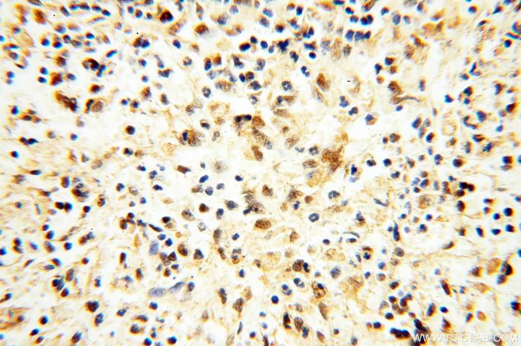 IHC staining of human spleen using 14055-1-AP