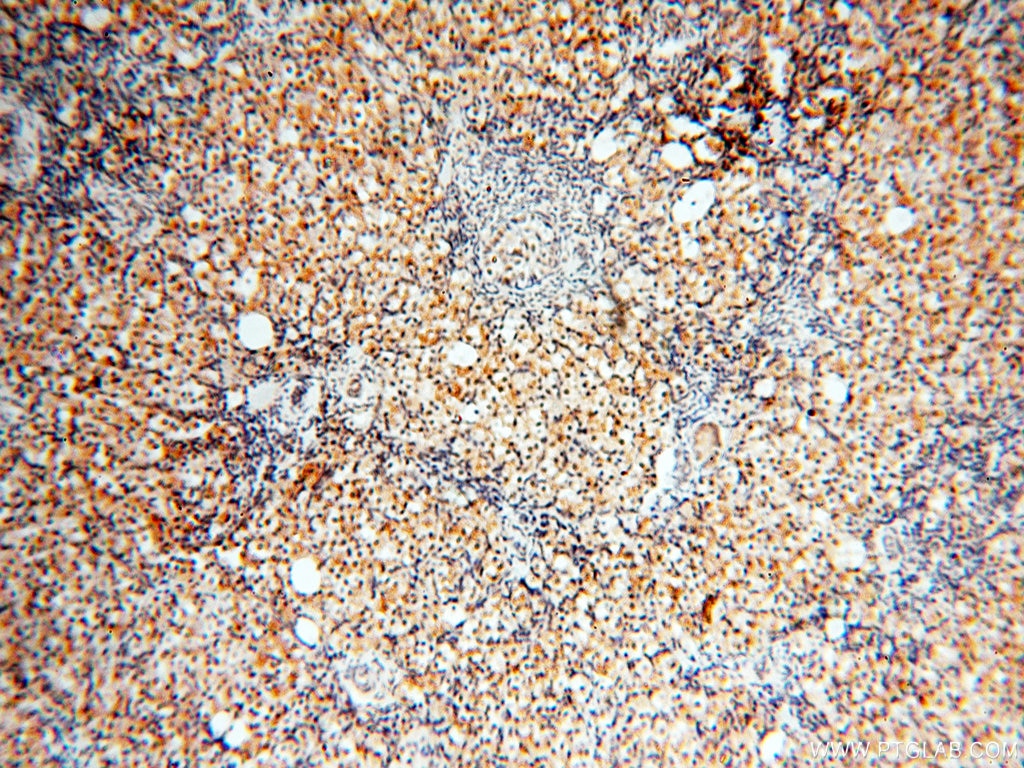 Immunohistochemistry (IHC) staining of human ovary tissue using USP16 Polyclonal antibody (14055-1-AP)