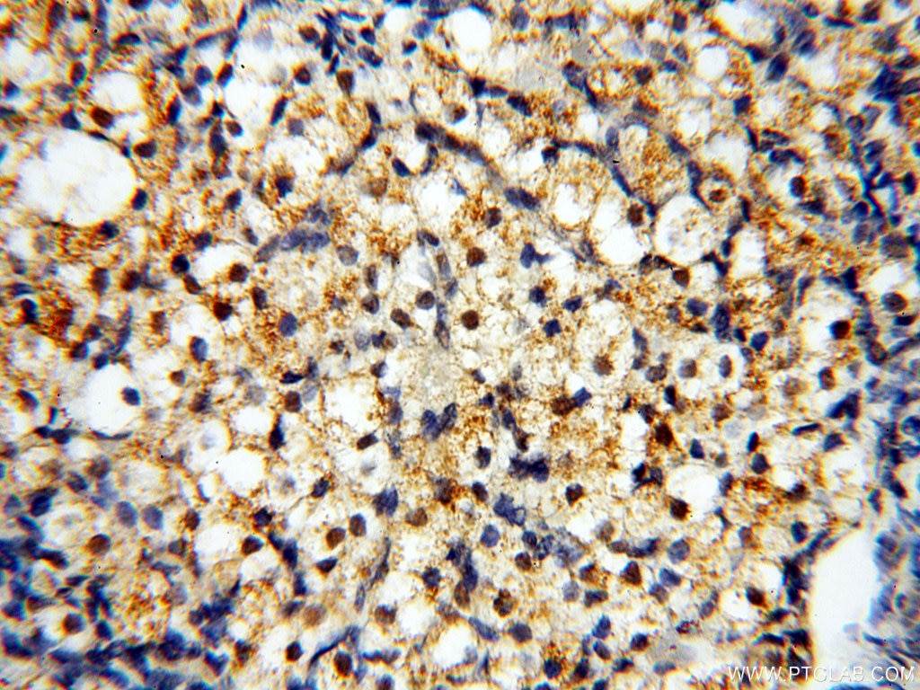 Immunohistochemistry (IHC) staining of human ovary tissue using USP16 Polyclonal antibody (14055-1-AP)