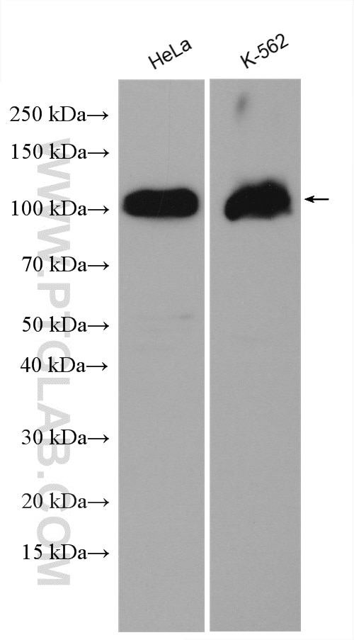 Western Blot (WB) analysis of various lysates using USP16 Polyclonal antibody (14055-1-AP)