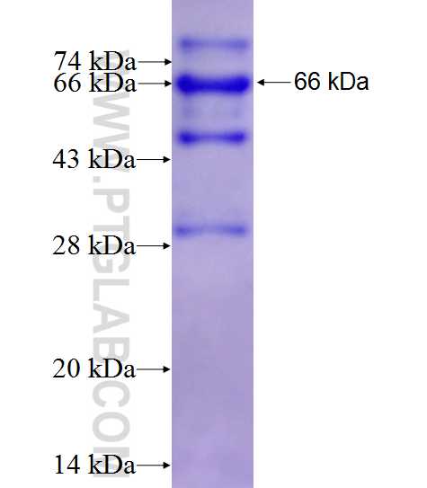 USP16 fusion protein Ag4981 SDS-PAGE