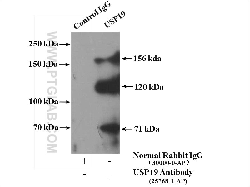 Immunoprecipitation (IP) experiment of Jurkat cells using USP19 Polyclonal antibody (25768-1-AP)