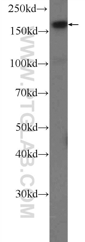 Western Blot (WB) analysis of Jurkat cells using USP19 Polyclonal antibody (25768-1-AP)