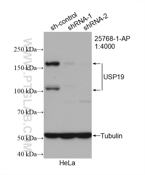 Western Blot (WB) analysis of HeLa cells using USP19 Polyclonal antibody (25768-1-AP)
