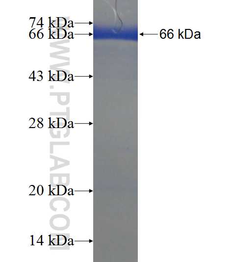 USP19 fusion protein Ag22646 SDS-PAGE