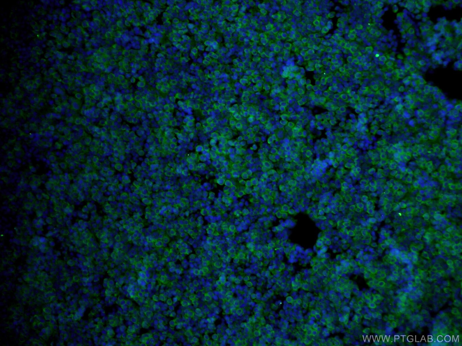 Immunofluorescence (IF) / fluorescent staining of mouse embryo tissue using USP2 Polyclonal antibody (10392-1-AP)