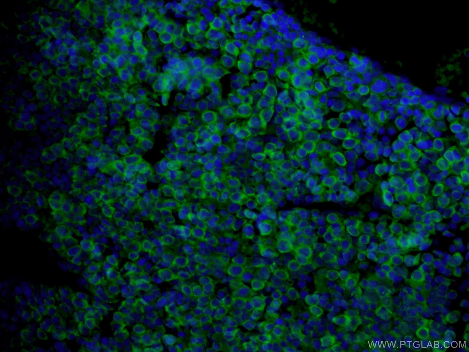 Immunofluorescence (IF) / fluorescent staining of mouse embryo tissue using USP2 Polyclonal antibody (10392-1-AP)