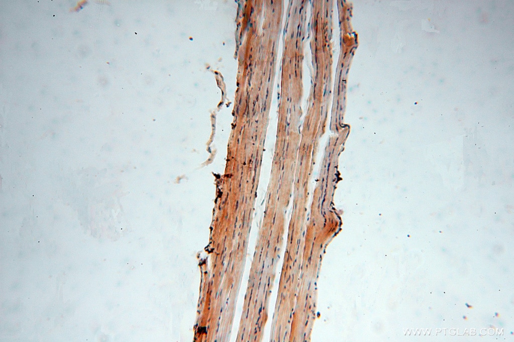 IHC staining of human skeletal muscle using 10392-1-AP
