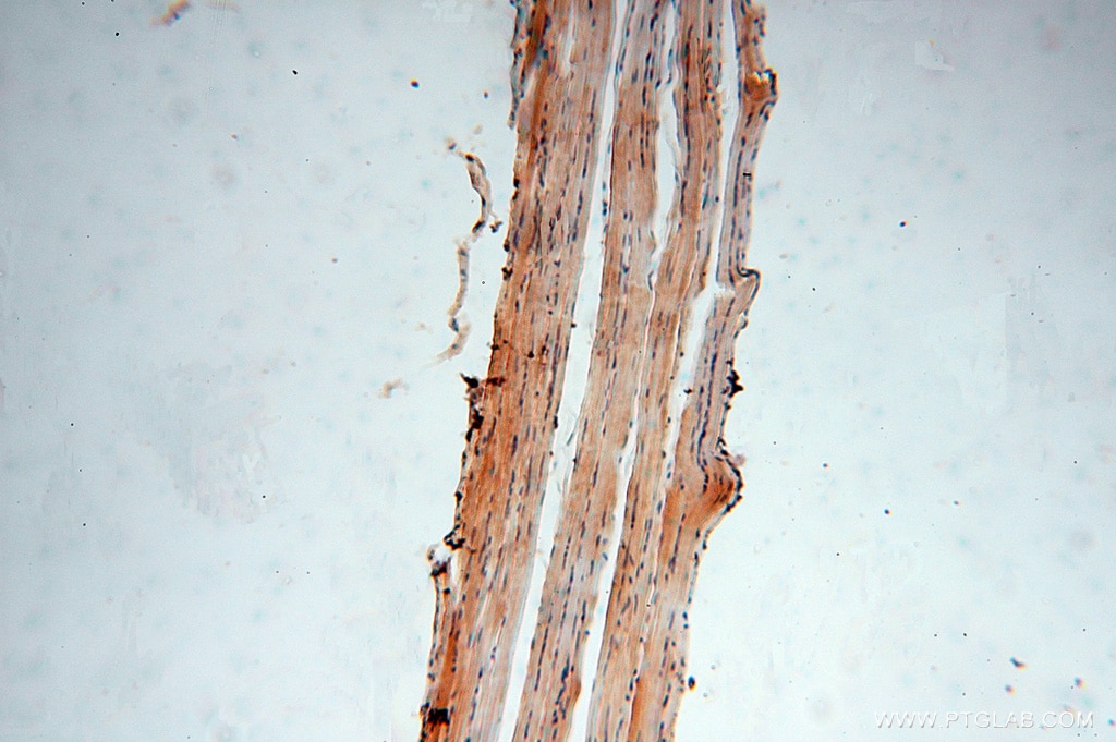 Immunohistochemistry (IHC) staining of human skeletal muscle tissue using USP2 Polyclonal antibody (10392-1-AP)