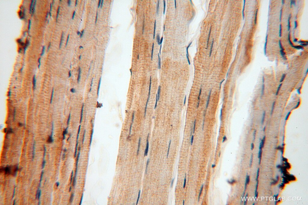 Immunohistochemistry (IHC) staining of human skeletal muscle tissue using USP2 Polyclonal antibody (10392-1-AP)