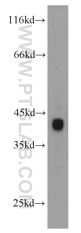 Western Blot (WB) analysis of mouse brain tissue using USP2 Polyclonal antibody (10392-1-AP)