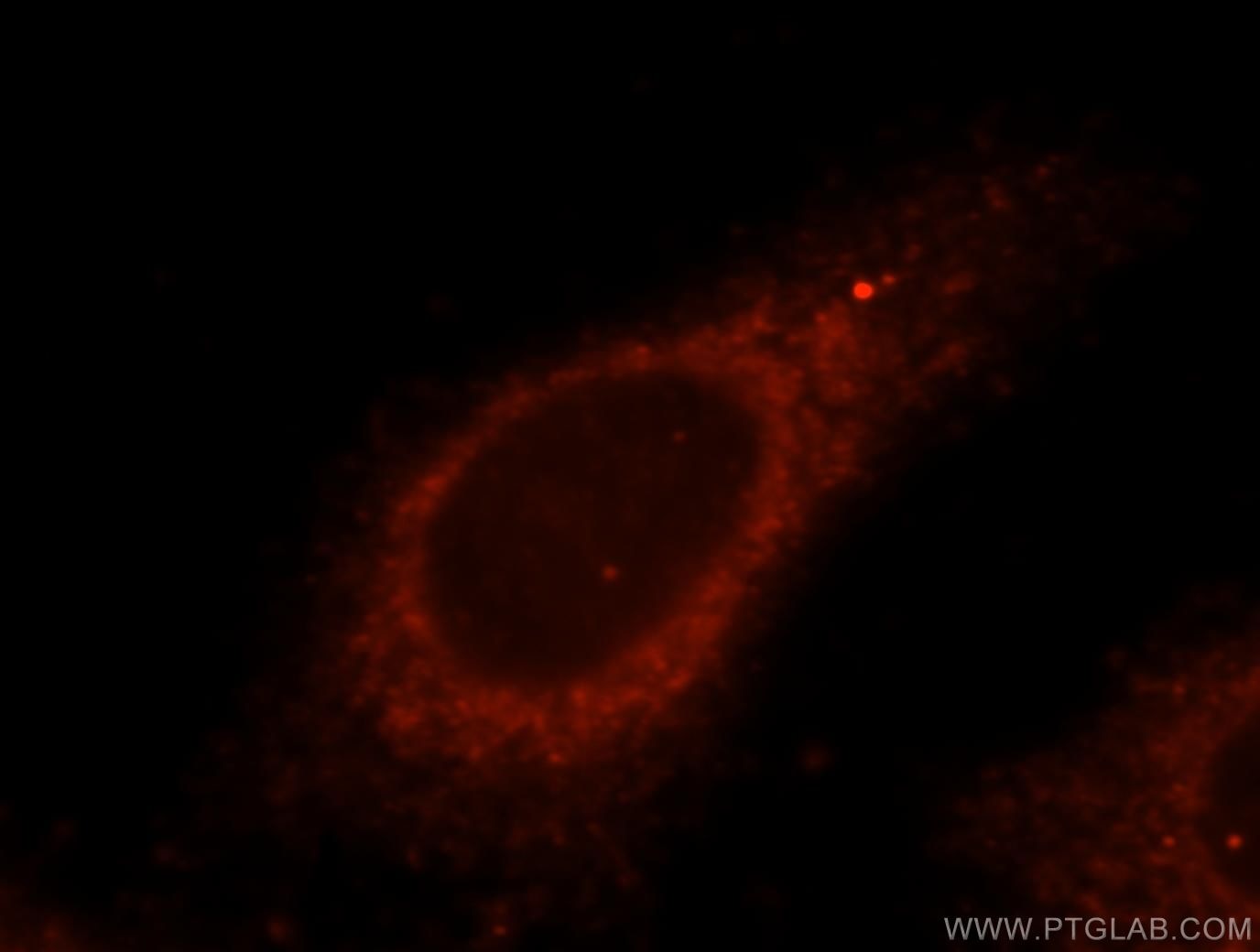 Immunofluorescence (IF) / fluorescent staining of HepG2 cells using USP2 Polyclonal antibody (15404-1-AP)