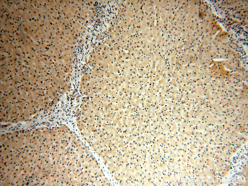 Immunohistochemistry (IHC) staining of human liver tissue using USP2 Polyclonal antibody (15404-1-AP)