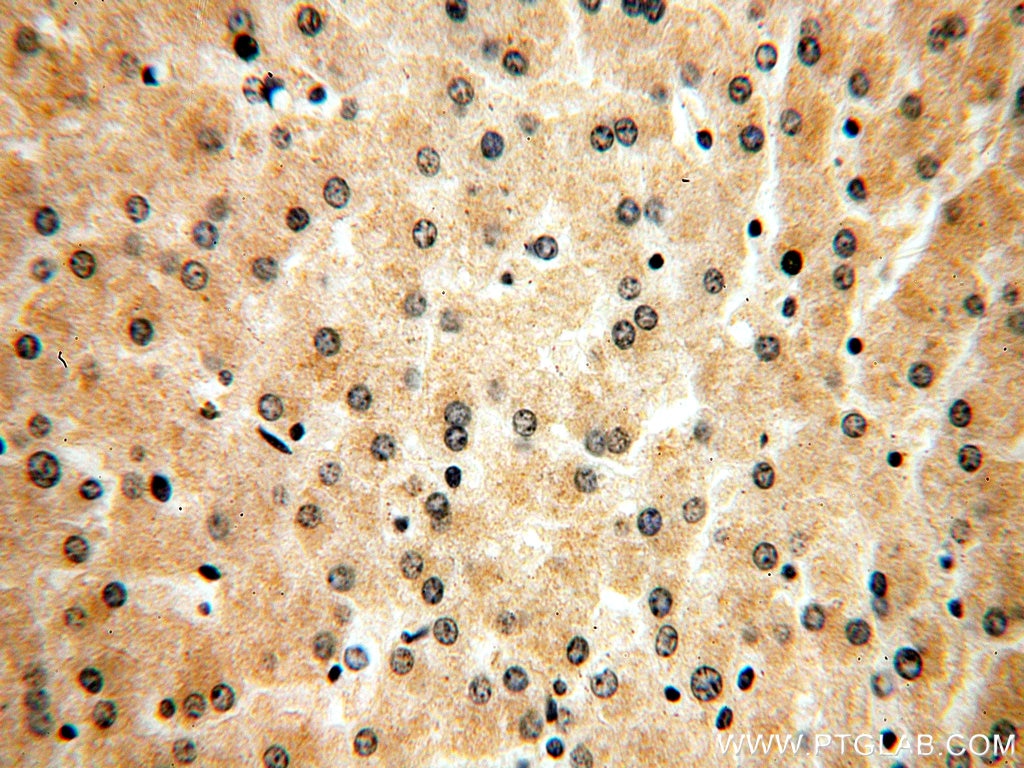 Immunohistochemistry (IHC) staining of human liver tissue using USP2 Polyclonal antibody (15404-1-AP)