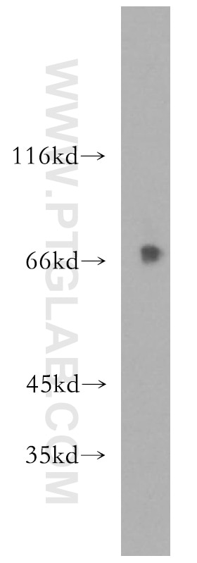 Western Blot (WB) analysis of mouse testis tissue using USP2 Polyclonal antibody (15404-1-AP)
