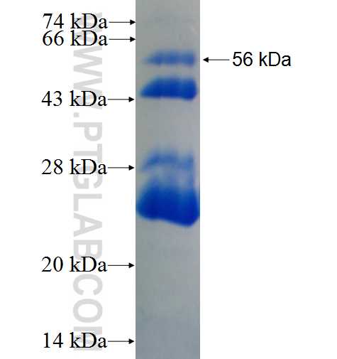 USP2 fusion protein Ag0591 SDS-PAGE