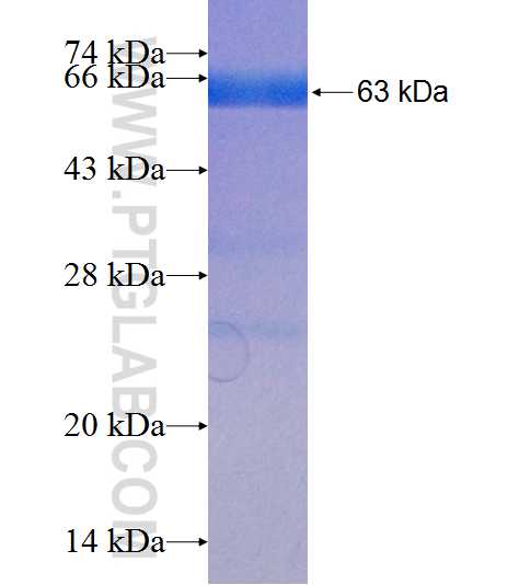 USP2 fusion protein Ag7658 SDS-PAGE