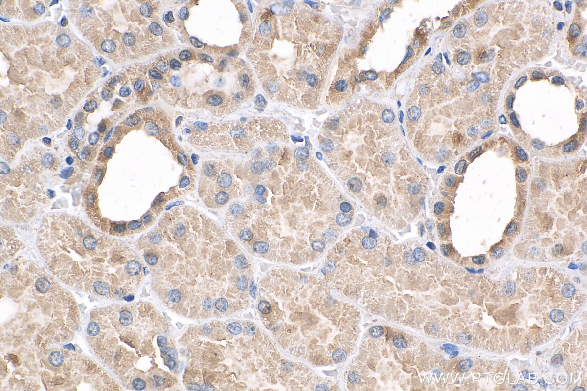 Immunohistochemistry (IHC) staining of human kidney tissue using USP20 Polyclonal antibody (17491-1-AP)