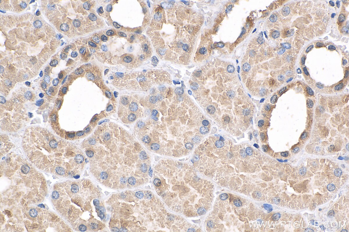 IHC staining of human kidney using 17491-1-AP