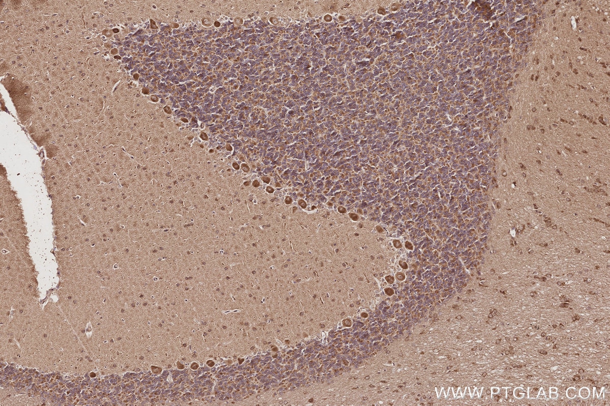Immunohistochemistry (IHC) staining of rat cerebellum tissue using USP20 Polyclonal antibody (17491-1-AP)